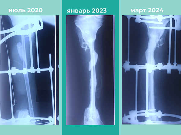 �������� �������. 